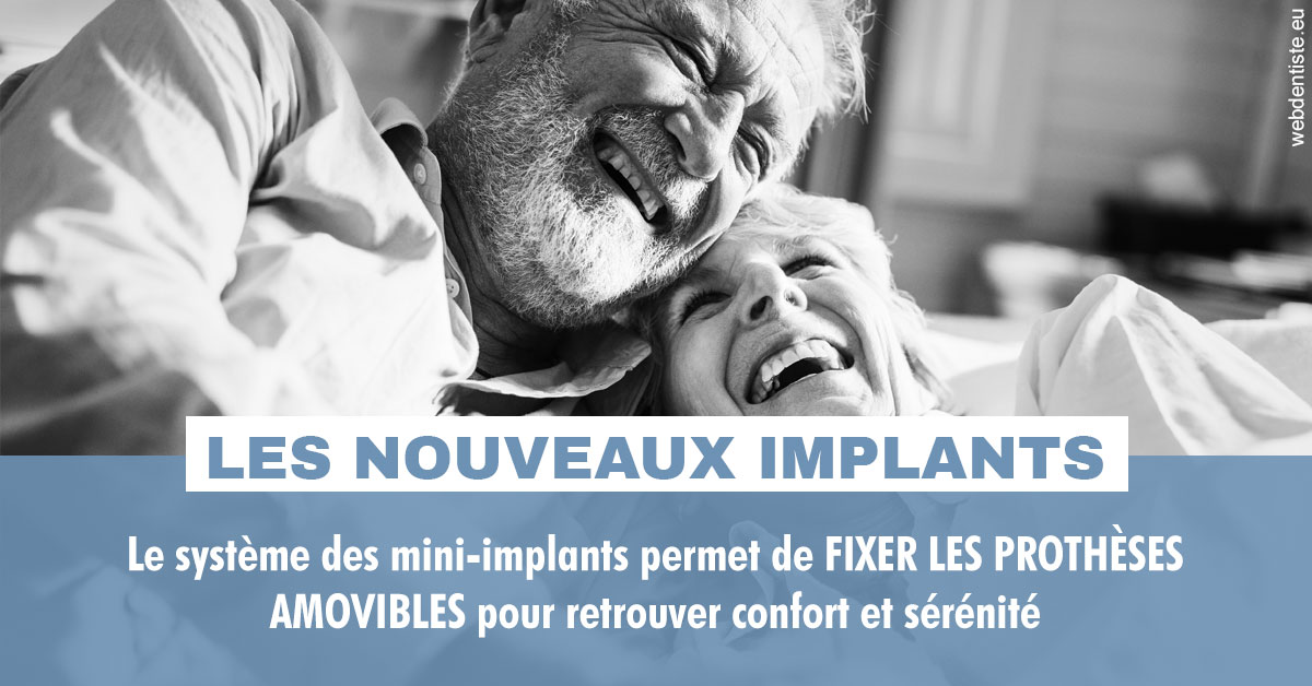 https://www.dentistesmerignac.fr/Les nouveaux implants 2