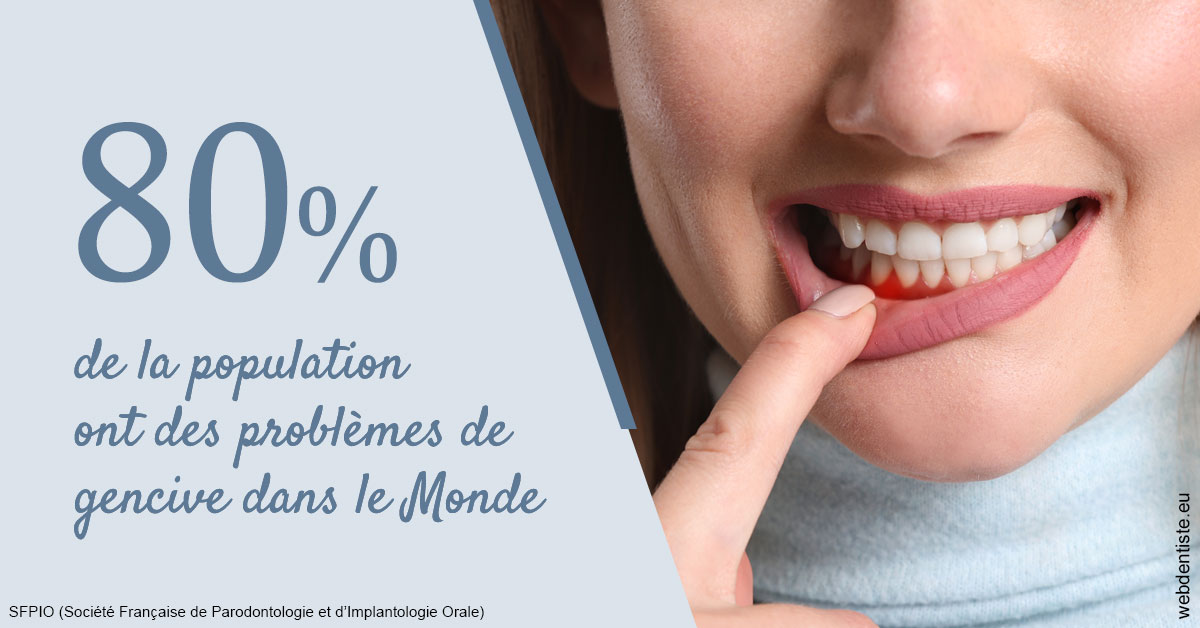 https://www.dentistesmerignac.fr/Problèmes de gencive 2