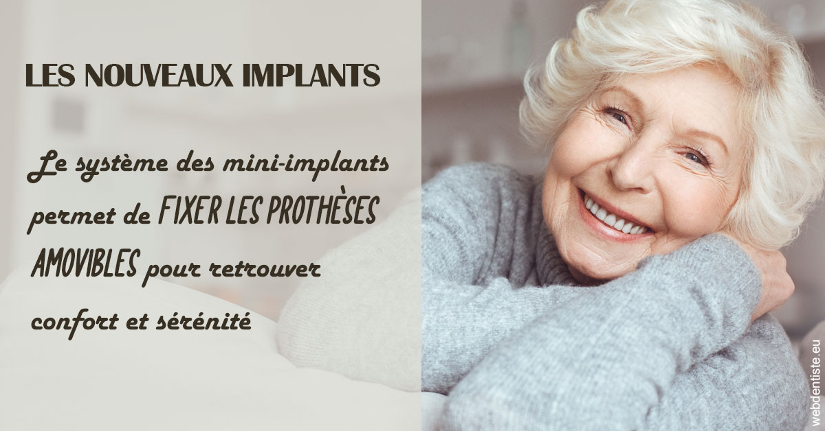https://www.dentistesmerignac.fr/Les nouveaux implants 1