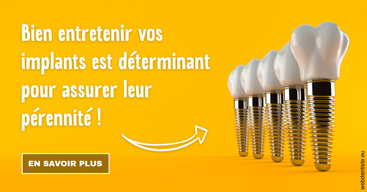 https://www.dentistesmerignac.fr/Entretien implants 2