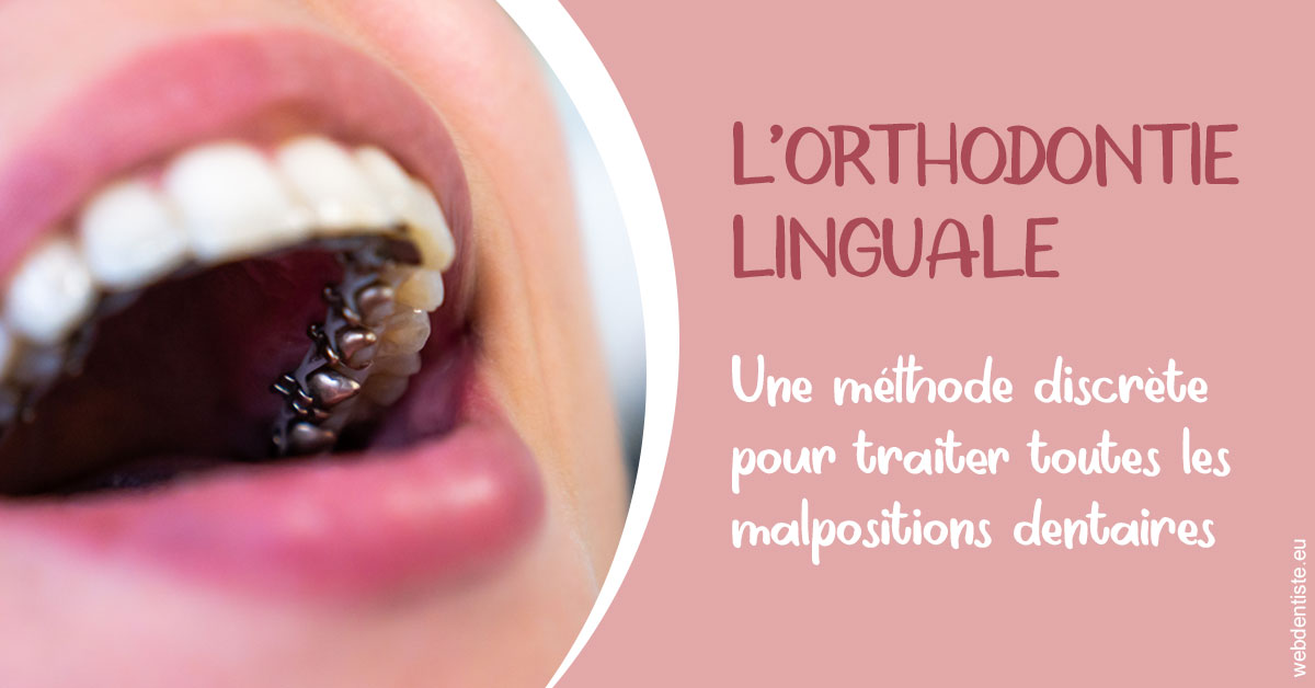 https://www.dentistesmerignac.fr/L'orthodontie linguale 2