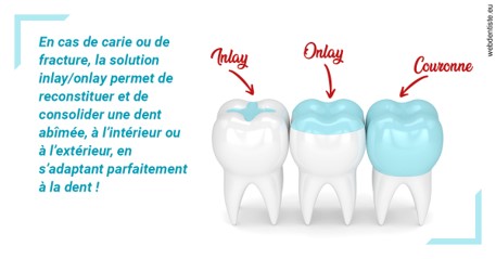 https://www.dentistesmerignac.fr/L'INLAY ou l'ONLAY