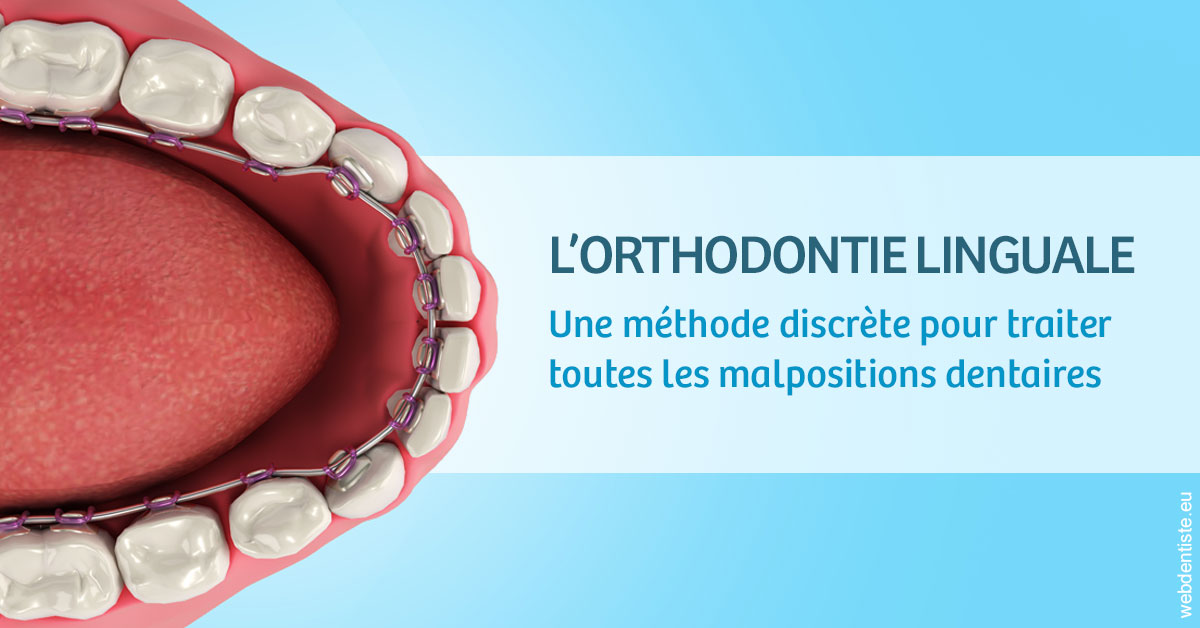 https://www.dentistesmerignac.fr/L'orthodontie linguale 1