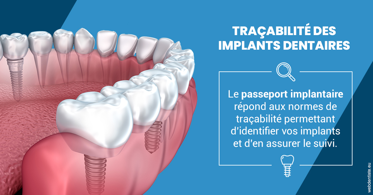 https://www.dentistesmerignac.fr/T2 2023 - Traçabilité des implants 1
