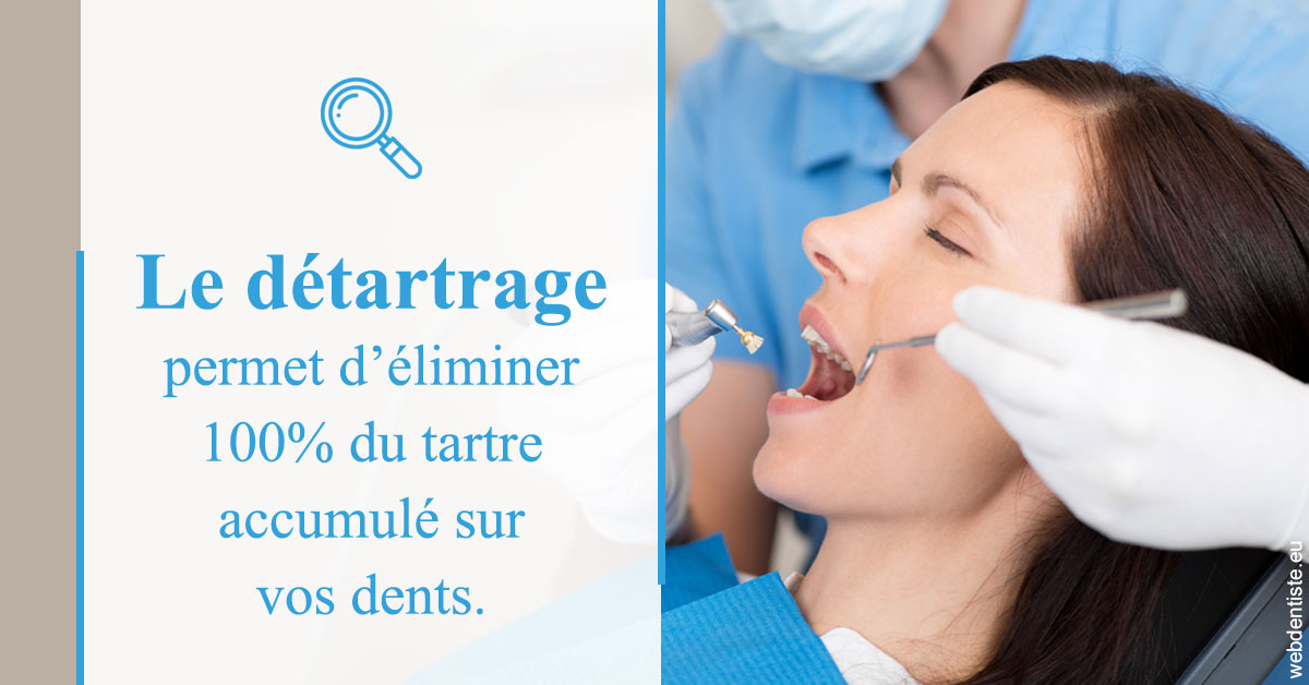 https://www.dentistesmerignac.fr/En quoi consiste le détartrage