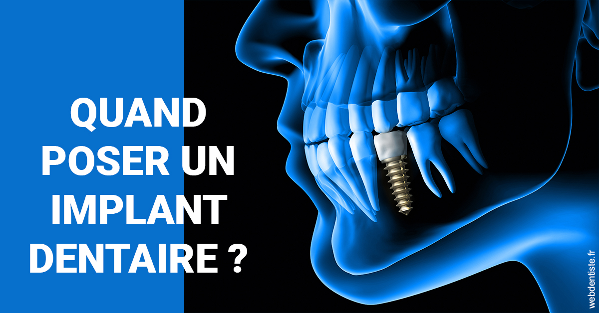 https://www.dentistesmerignac.fr/Les implants 1