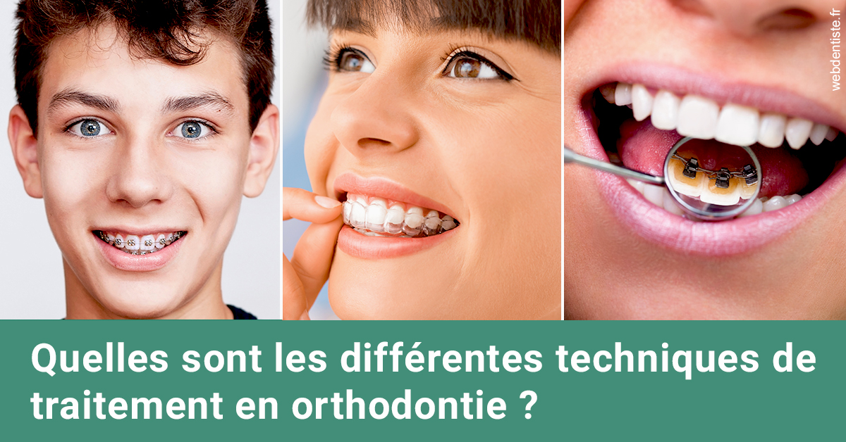 https://www.dentistesmerignac.fr/Les différentes techniques de traitement 2