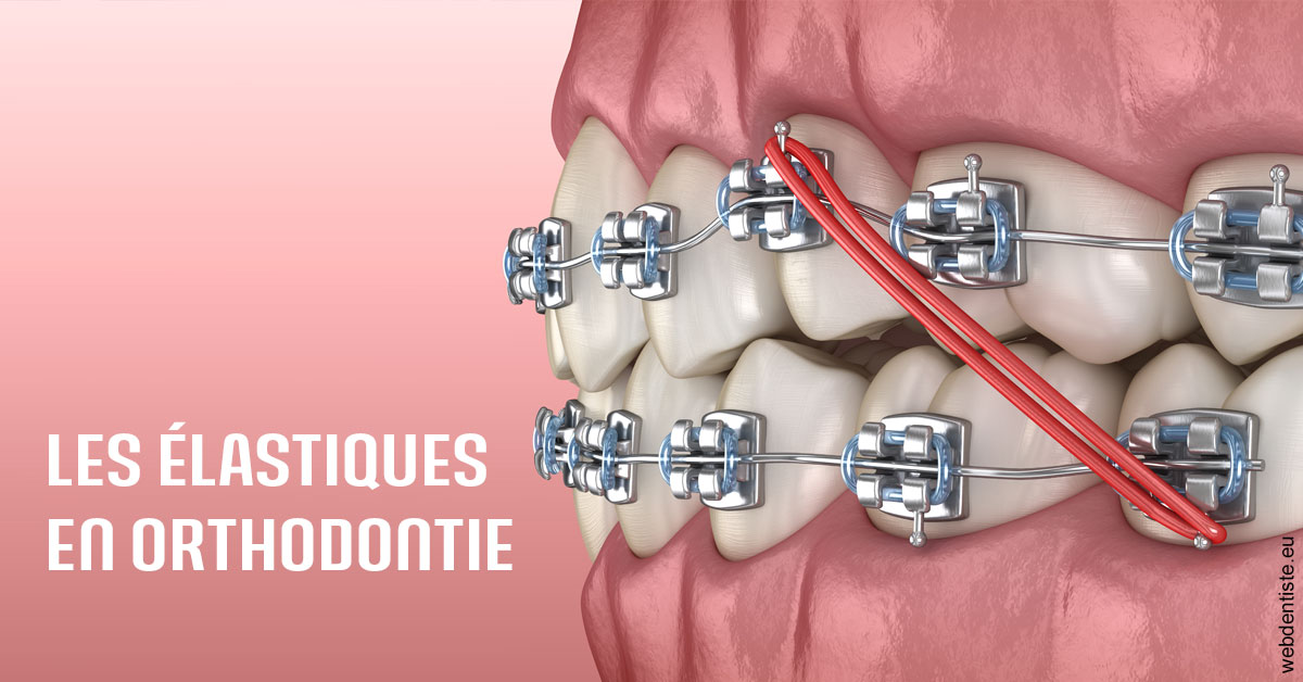 https://www.dentistesmerignac.fr/Elastiques orthodontie 2