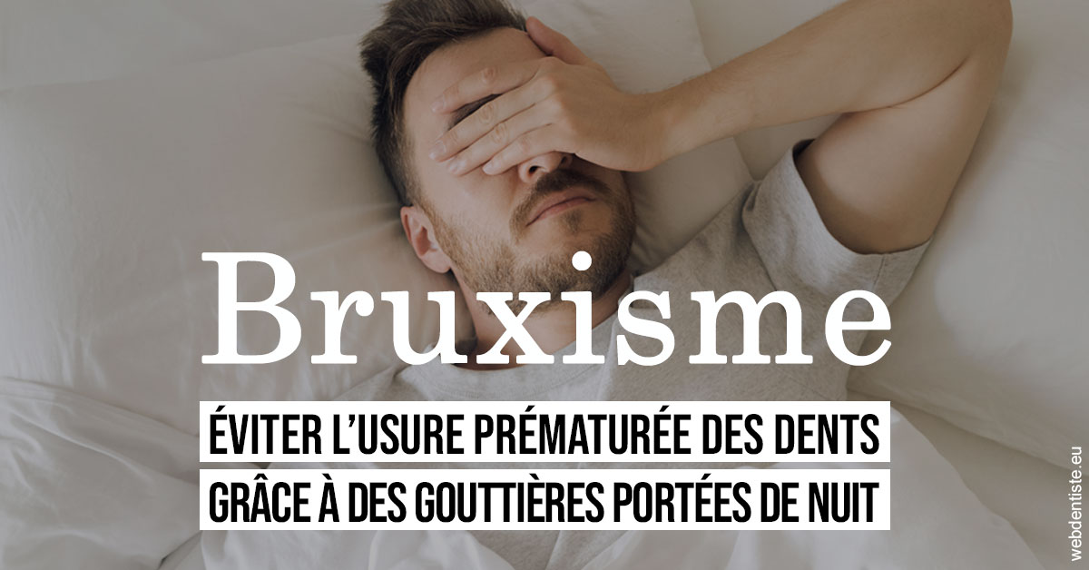 https://www.dentistesmerignac.fr/Bruxisme 1