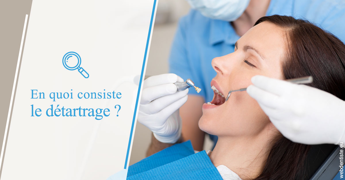 https://www.dentistesmerignac.fr/En quoi consiste le détartrage