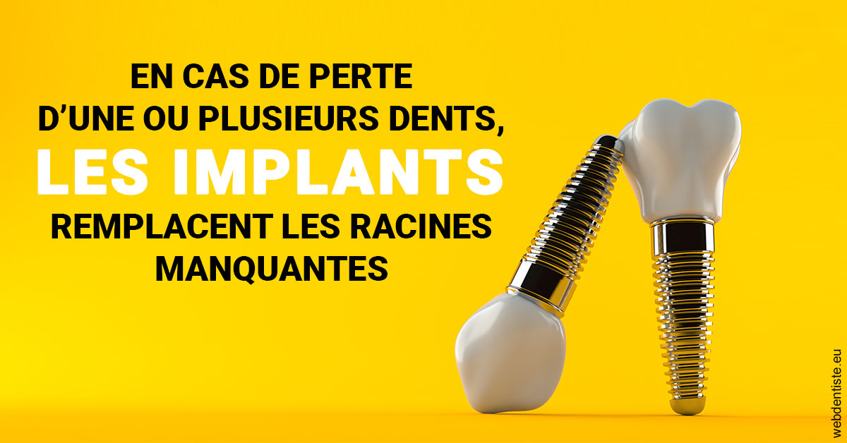 https://www.dentistesmerignac.fr/Les implants 2